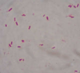 E. Coli (Escherichia coli), / EHEC / ETEC / Virtsatieinfektio (useita kokoja)