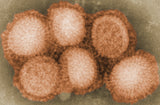 Influenssa / flunssa / ortomyksovirus / influenssa / H1N1