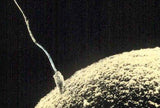 Munasolu suuri pehmeä eläin (halkaisija noin 40 cm) / naarassukusolu / munasolu (ihmisen munasolu) / jättiläismikrobit Yhdysvalloista