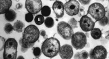 Klamydia / Chlamydia (Chlamydia trachomatis) - halkaisija noin 40 cm