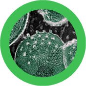 Klamydia / Chlamydia (Chlamydia trachomatis) - halkaisija noin 40 cm