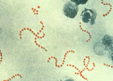 Streptococcus pyogenes gossedjur ca.25x50cm / "Flesh Eating"