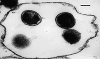 Klamydia / Chlamydia (Chlamydia trachomatis) - halkaisija noin 40 cm