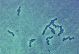 E. Coli (Escherichia coli), / EHEC / ETEC / Virtsatieinfektio (useita kokoja)